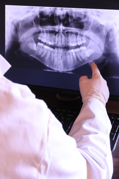 Best Emergency Dental Care for Broken or Chipped Teeth in Lake Caroline, VA