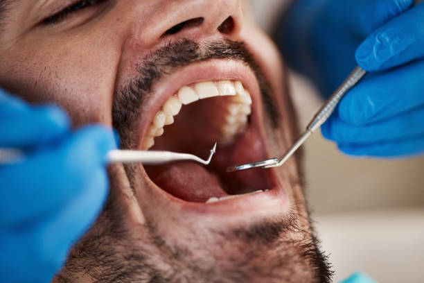 Best Emergency Dental Care for Broken or Chipped Teeth in Lake Caroline, VA