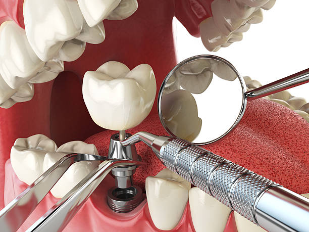 Best Same-Day Emergency Dental Services in Lake Caroline, VA